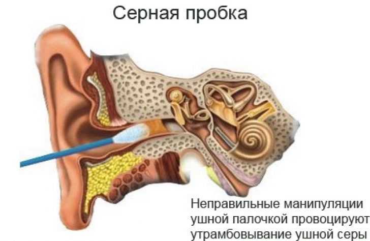 Очистка слухового аппарата: рекомендации - signia hearing aids